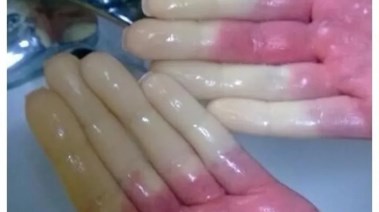 ظاهرة رينود 