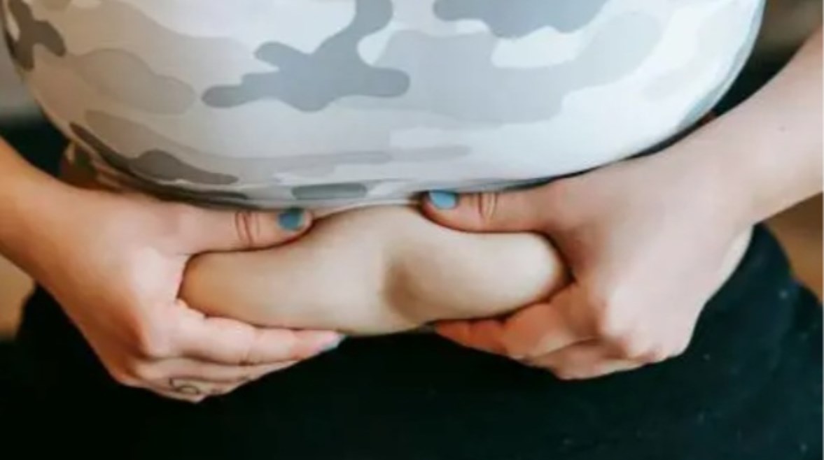 دهون البطن - صورة أرشيفية