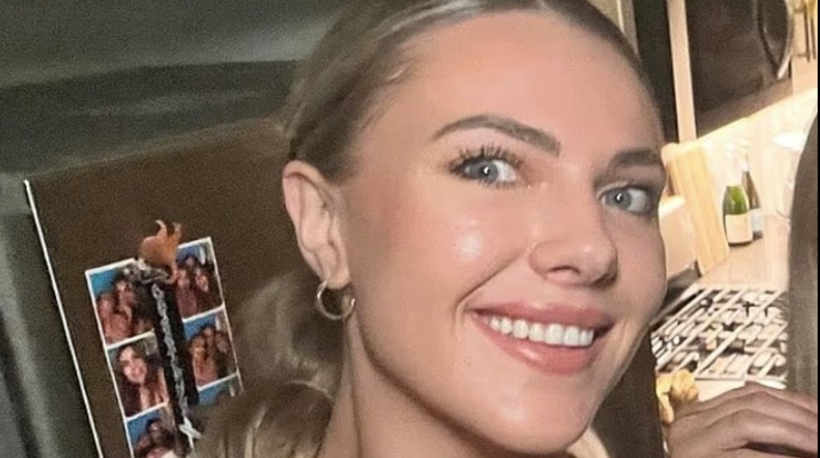  آسبن بروك التي أجرت عمليات تجميل بسبب هوس الفلاتر