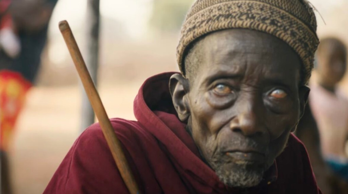 انتشار العمى النهري في أفريقيا