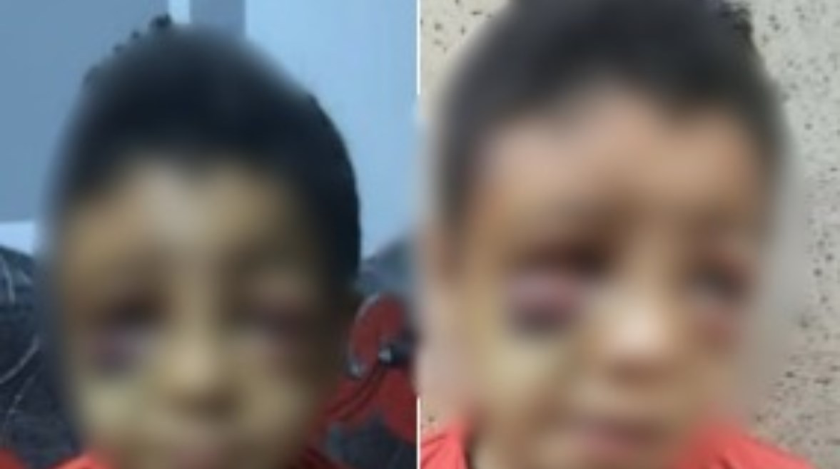 الصغير المصاب