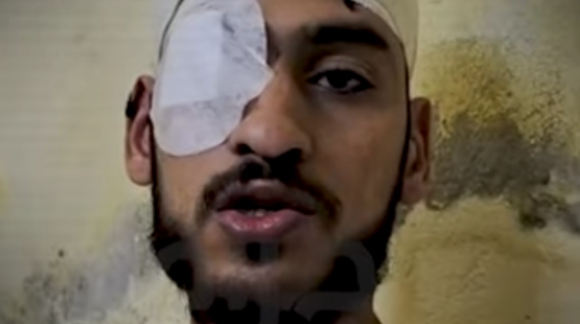 الشاب عبدالرحمن المعتدي عليه من جيرانه بالزاوية الحمراء