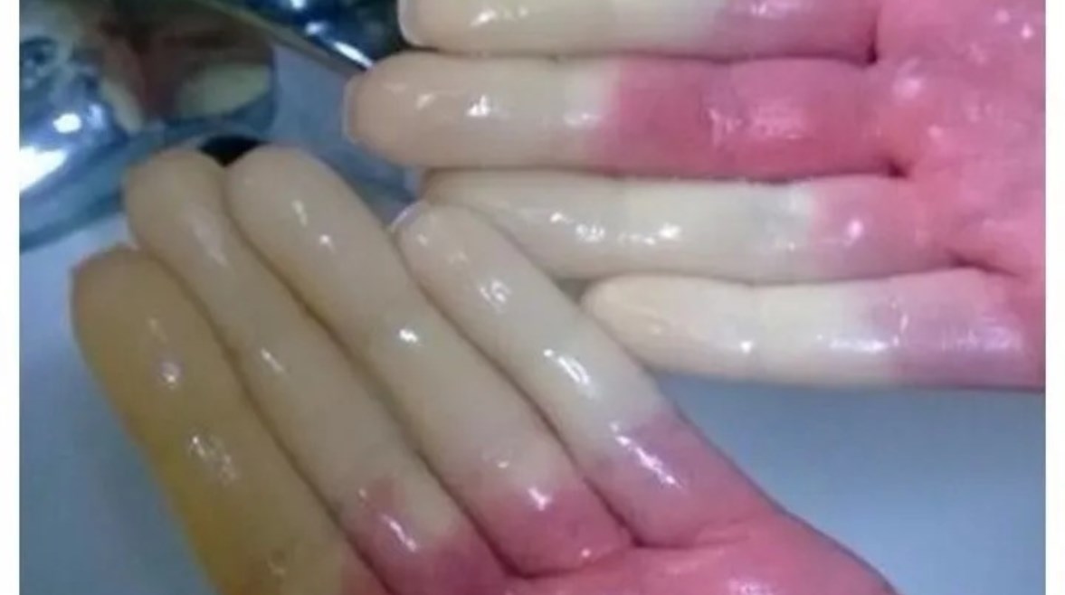 ظاهرة رينود 