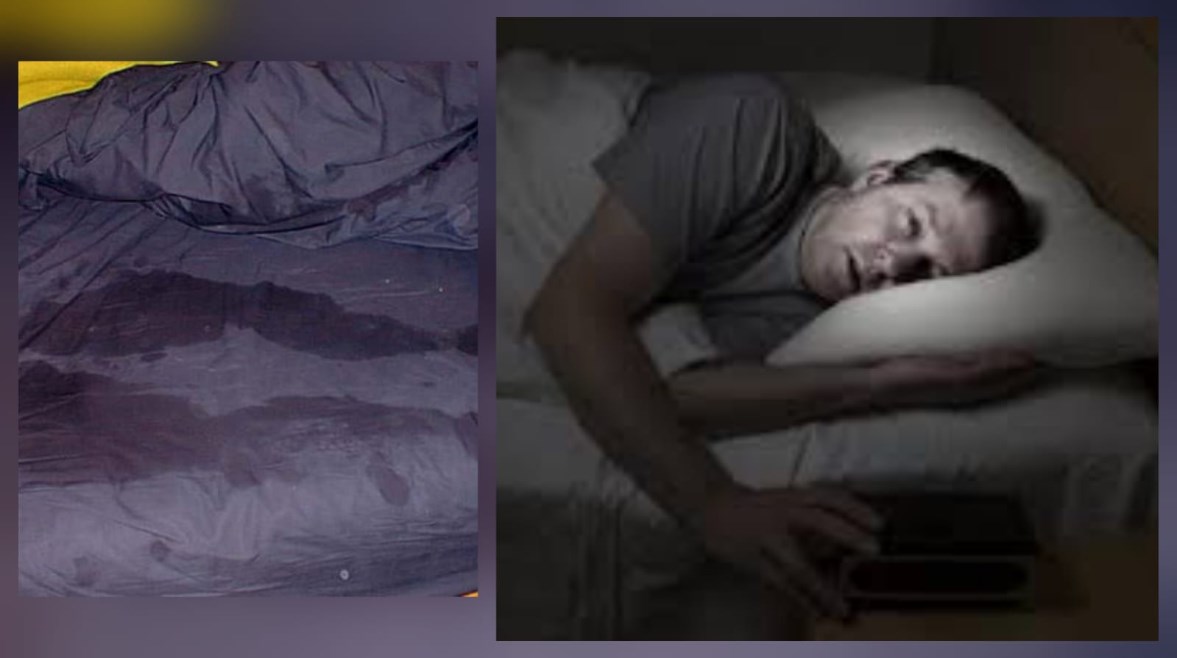 التعرق أثناء النوم