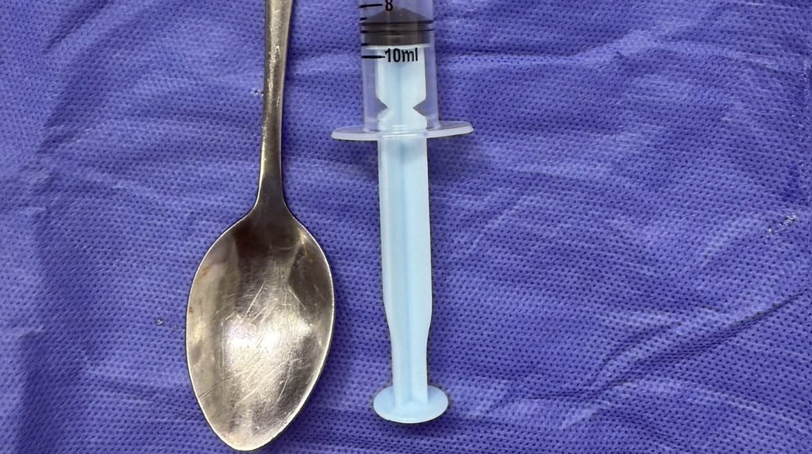 الملعقة بعد استخراجها