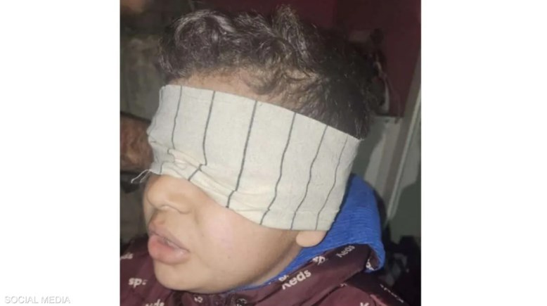 الطفل الفلسطيني معصوب العينين
