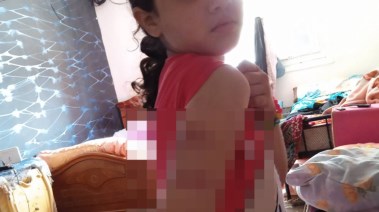 طفلة تتعرض للاعتداء من والدها