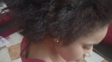 صورة الطفلة جنا المعتدي عليها من زوجة ابيها بسوهاج