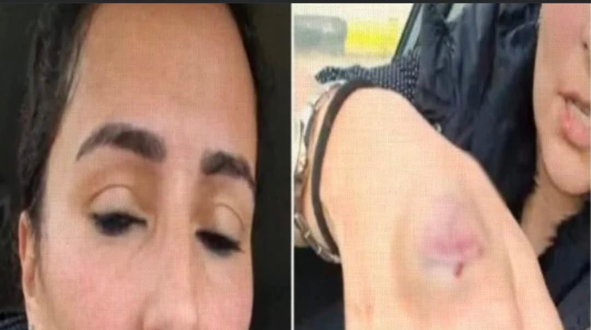 طبيبة الشيخ زايد طبيبة الشيخ زايد