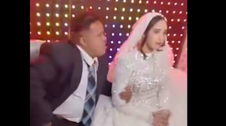 جانب من زواج فتاة من عريس متلازمة داون