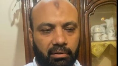  طبيب " حبيبة "الناجية من حادث الطريق الإقليمي بالمنوفية