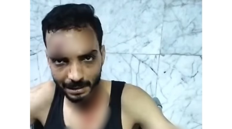 الشاب المعتدى عليه بمدينة نصر