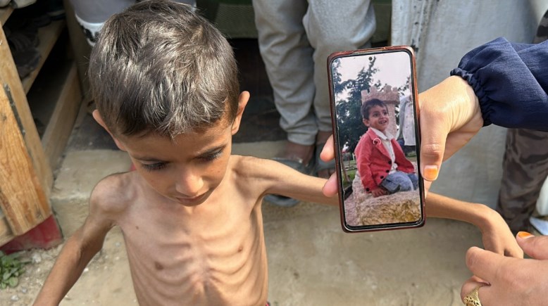 أطفال غزة بسبب الحرب الإسرائيلية 