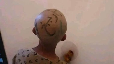 الطفل المعنف