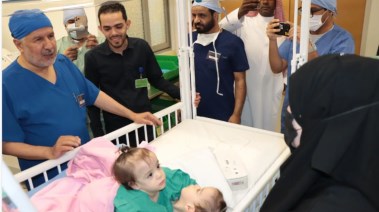 عملية فصل التوأم الملتصق السوري "سيلين وإيلين”