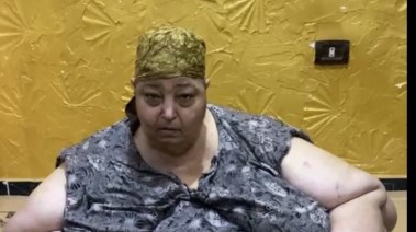 الحاجة فاطمة مريضة السمنة المفرطة