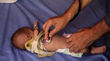 رضيع في غزة يموت بسبب نقص الغذاء