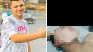 المجني عليه وجانب من الإصابة 