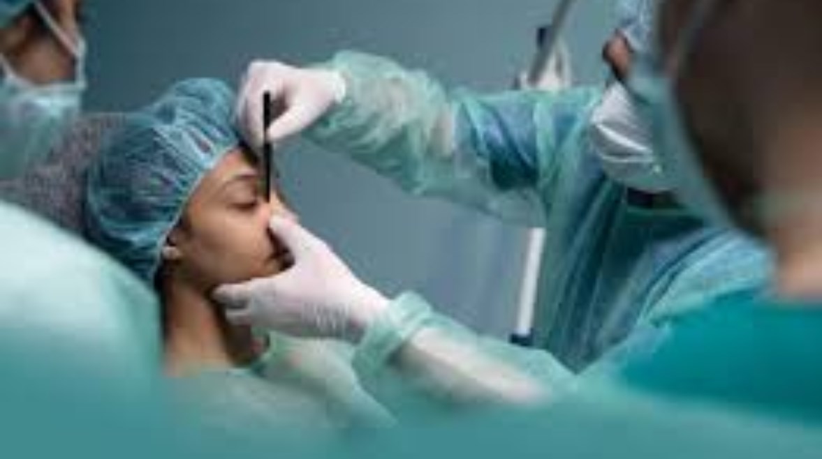 عملية تجميل عملية تجميل