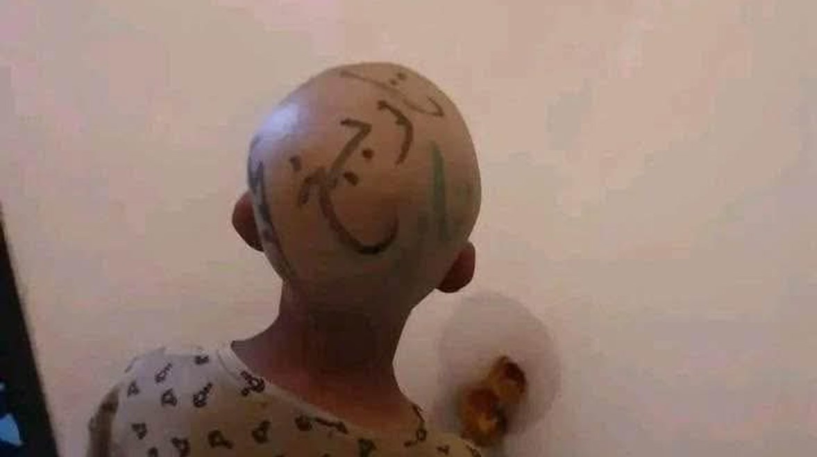 الطفل المعنف الطفل المعنف