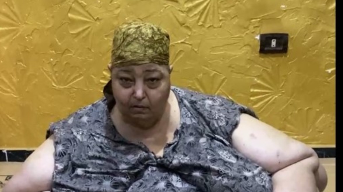 الحاجة فاطمة مريضة السمنة المفرطة