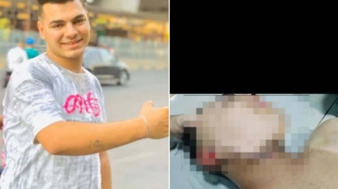 المجني عليه وجانب من الإصابة 