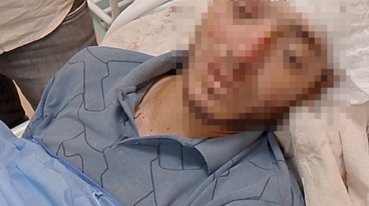 يحيى عبد الفتاح السبكى مصاب حادث الإقليمي يحيى عبد الفتاح السبكى مصاب حادث الإقليمي