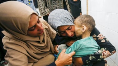 صورة توضح سوء التغذية في غزة