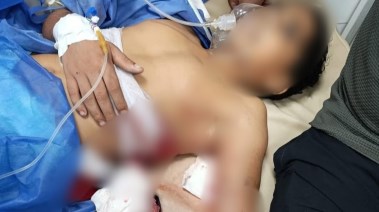 ضبط متهم أصاب طفلًا بطلق خرطوش خلال مشاجرة بحي الزهور ببورسعيد  