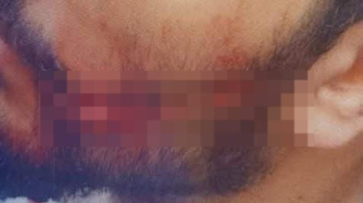 جانب من إصابة الطبيب جانب من إصابة الطبيب