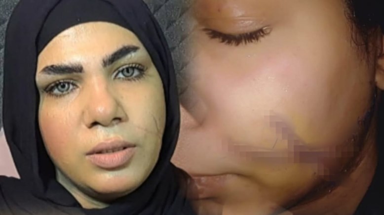 الضحية "مروة"