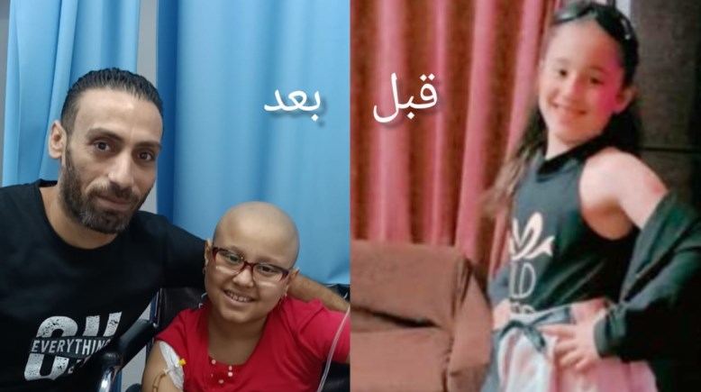 الطفلة هنا مريضة سرطان في العظام