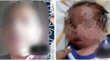 الطفلة وطليق الشاكية