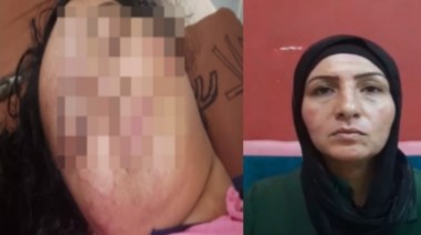 الطفلة سما ووالدتها 