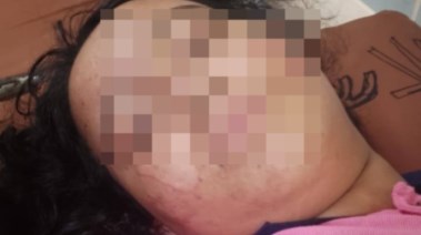 الطالبة المصابة