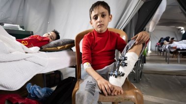دراسة طبية: إصابات مدنيي غزة تماثل جروح الجنود في ساحات الفتال