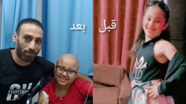 الطفلة هنا مريضة سرطان في العظام