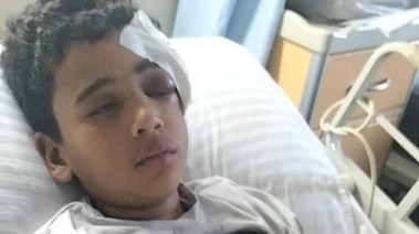 إصابة طفل بوهة شطانوف في قطار بالمنوفية 