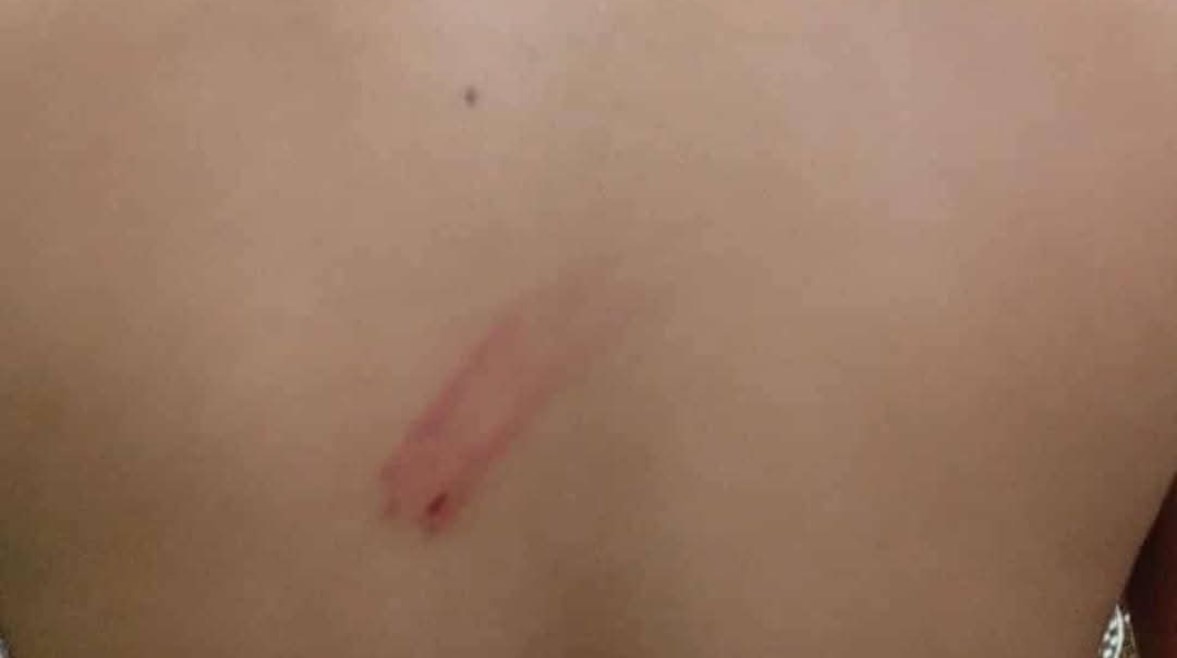 صورة للطالب المعتدي عليه 