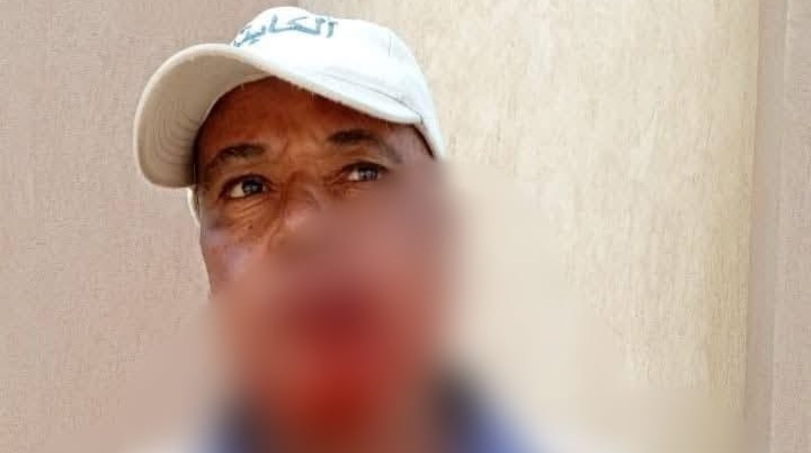فرد الأمن المجني عليه 