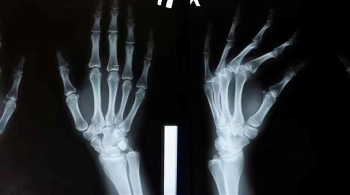 غراء العظام غراء العظام
