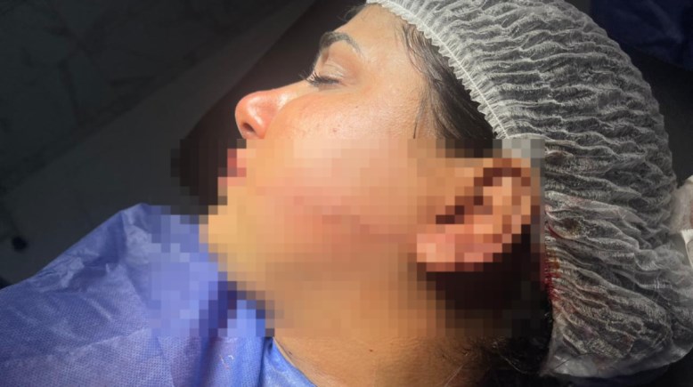 سمر ضحية الشرقية