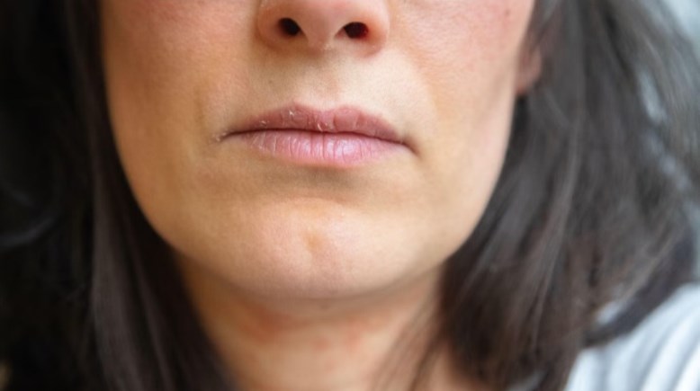 جفاف الفم إحدى علامات عدم شرب الماء