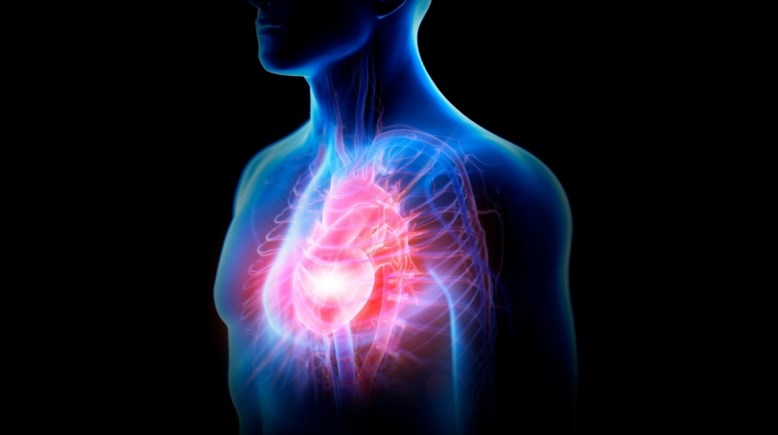 النوبة القلبية- تعبيرية