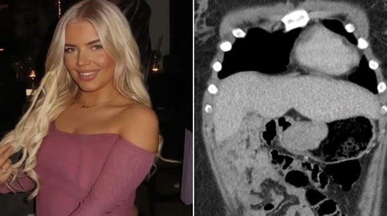 السيدة بيلا بايليس