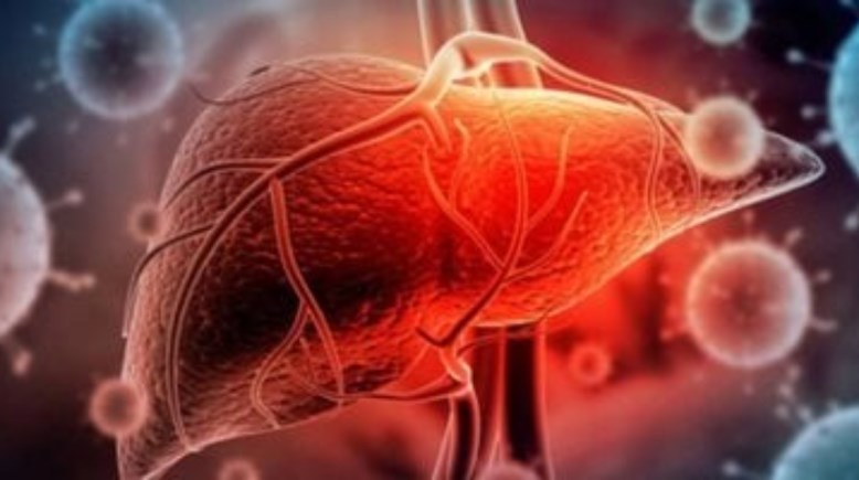 علامات السموم بالكبد 