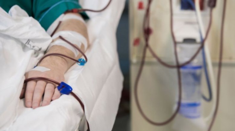 جلسة غسيل كلوي - أرشيفية