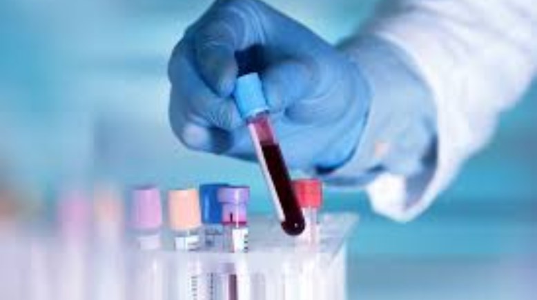 صورة - تعبيرية