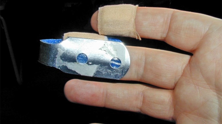 عضة بالإصبع- أرشيفية