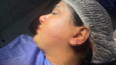 سمر ضحية الشرقية